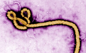 Virus Ebola có khả năng tồn tại trong não suốt nhiều năm liền