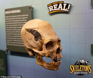 Hộp sọ chiến binh 2.000 năm có chi tiết lạ kỳ gây kinh ngạc