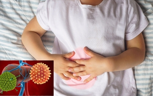 Chuyên gia gan mật khuyến cáo những lưu ý cần biết về viêm gan cấp ở trẻ