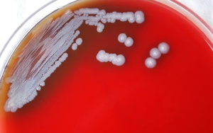 Mỹ lần đầu phát hiện 'vi khuẩn ăn thịt người' trong mẫu đất và nước