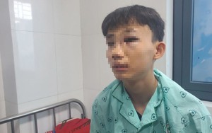 Diễn biến mới vụ nam sinh lớp 10 ở Bình Định bị đánh hội đồng đến gãy sống mũi