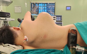&quot;Giải cứu&quot; thiếu niên 16 tuổi khỏi khối u máu khổng lồ &quot;treo&quot; ở ngực