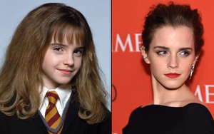 Lý do sao nữ Harry Potter tạm ngưng diễn xuất?