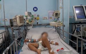 7 trẻ mắc tay chân miệng tử vong, Bộ Y tế họp khẩn với 20 tỉnh miền Nam