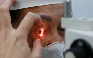 Gia tăng bệnh nhân đau mắt đỏ, nguy cơ biến chứng nặng ảnh hưởng đến thị lực