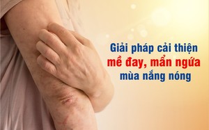 Hết mề đay, mẩn ngứa ngày hè – Giải pháp hiệu quả, tránh tái phát