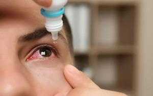 Cách dùng thuốc trị đau mắt đỏ đúng và hiệu quả nhất