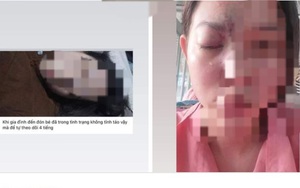 Vụ thiếu nữ 17 tuổi bị mù sau khi tiêm filler ở Đồng Nai: Spa chỉ được cấp phép... cắt tóc, gội đầu