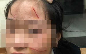 Vụ nữ sinh lớp 6 bị bạn đánh rách mặt ở Hà Nội vì chuyện tình cảm: Đã có kết luận cuối cùng