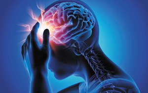 Dấu hiệu đau đầu nguy hiểm cảnh báo bệnh trọng