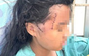 TIN NÓNG 24 GIỜ QUA: Bé gái nghi bị cha dượng bạo hành; tin mới phiên xử vụ Vạn Thịnh Phát