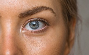 Chớp mắt quá nhiều là dấu hiệu của 7 tình trạng sức khoẻ gì?