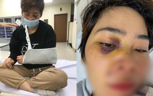 Nữ nhân viên Xí nghiệp Thủy lợi ở Hà Nội tố bị hành hung chấn động não khi nhắc nhở xây lấn chiếm mương