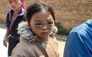 Đánh học sinh lớp 1 tím mắt, một giáo viên ở Yên Bái bị đình chỉ công tác