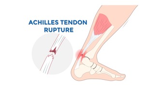 Nhiễm giun chó mèo: Sẩn ngứa khắp cơ thể, giun nổi ngoằn nghèo dưới da - Ảnh 3.