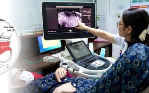 Suy tim, phù phổi, xơ gan vì bị cơn bão giáp trạng - Ảnh 4.
