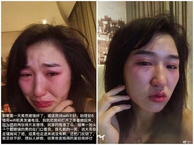 Nữ diễn viên Trung Quốc chuyên đóng thế cảnh khỏa thân, tự tung tin bị cưỡng bức hiện tại như thế nào? - Ảnh 1.