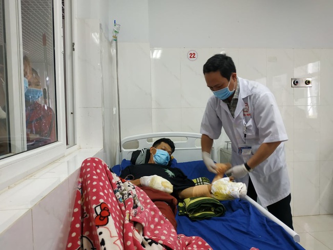 Tết 2021: Nhiều người ở Đắk Lắk thương tích nặng do tai nạn pháo nổ - Ảnh 1.
