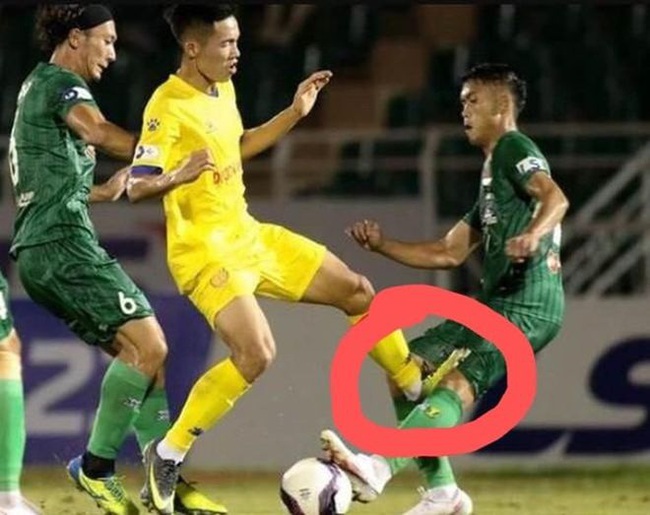 Cầu thủ Sài Gòn FC bị đạp móp đầu gối, người tung chân vô tội?!  - Ảnh 2.