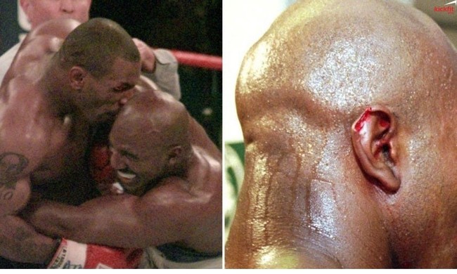 Mike Tyson cắn đứt tai Evander Holyfield: Điều gì xảy ra với mảnh tai? - Ảnh 2.