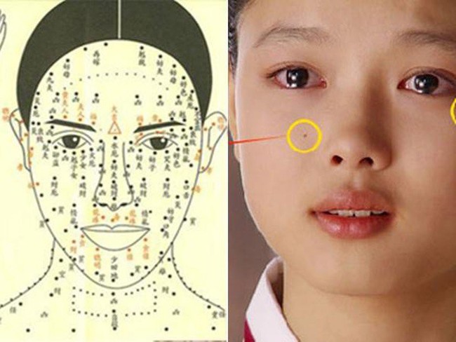 Decoding moles on women's cheeks: Prosperity or burden?  - Photo 1.