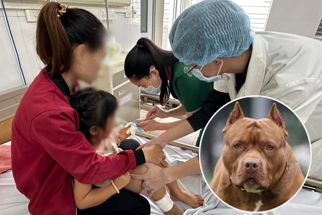 Hà Nội: Bé gái 4 tuổi bị chó Pitbull cắn vào mặt, phải khâu hàng chục mũi - Ảnh 1.