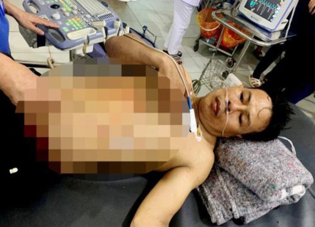 Hà Tĩnh: Cô gái sinh năm 1994 bị người tình đâm nhiều nhát vào ngực đã tử vong - Ảnh 1.