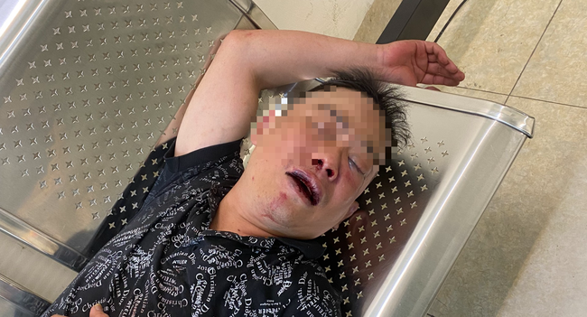 Góc nhìn pháp lý vụ người đàn ông bị đánh gục gần cửa nhà ở Hà Nội - Ảnh 1.