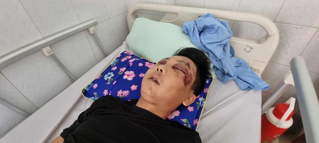 CT huyện Hoằng Hóa chỉ đạo làm rõ vụ : Hai đối tượng đánh đập dã man người đàn ông dù đã nằm bất tỉnh - Ảnh 2.