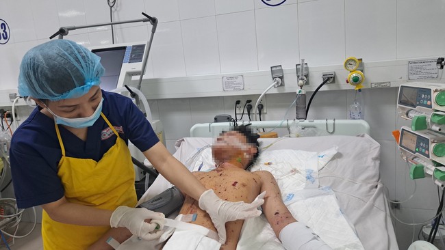 Đà Nẵng: Nhiều trường hợp đa chấn thương nặng nhập viện do pháo nổ- Ảnh 1.