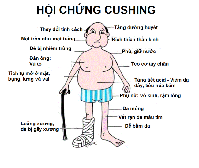 Tự ý dùng thuốc Corticoid, nhiều bệnh nhân mặt to, bụng lớn, tay chân teo- Ảnh 1.