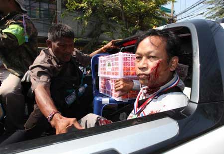 Một người biểu tình bị thương do mảnh bom khiến máu chảy đầy mặt