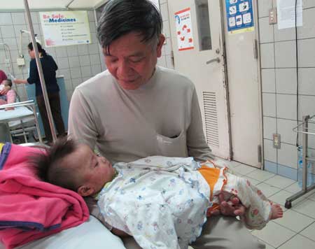 Trẻ điều trị bệnh sởi tại khoa Nhi (Bệnh viện Bạch Mai - Hà Nội).