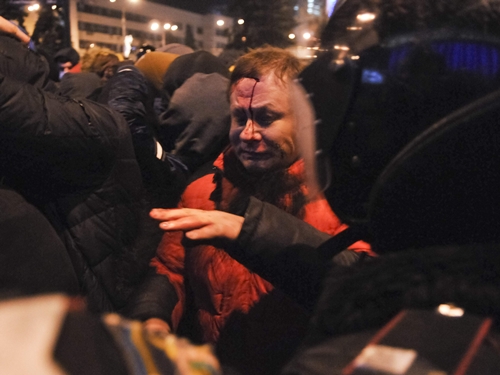 Một người biểu tình bị thương trong cuộc đụng độ hôm qua ở Donetsk. Ảnh: Reuters.