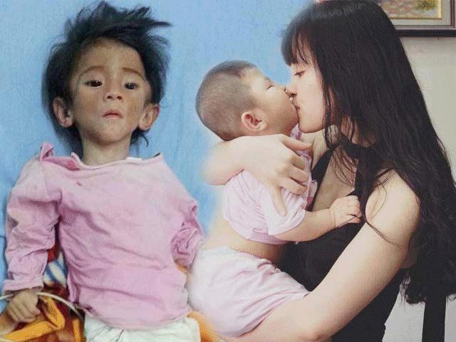 Cô gái nhận nuôi em bé suy dinh dưỡng: ”Lấy chồng vẫn đưa con theo”