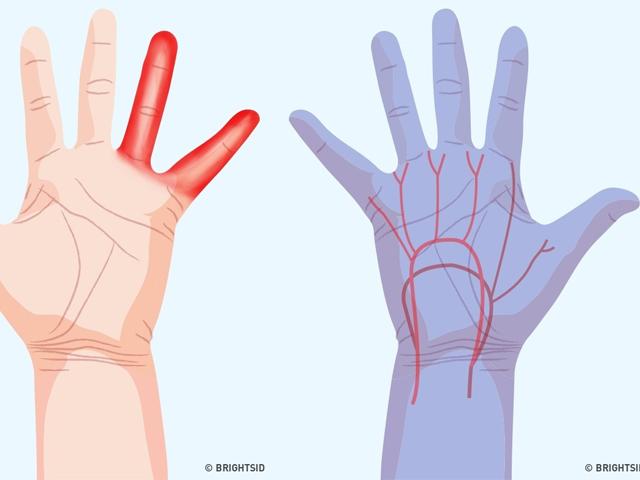 Bàn tay xuất hiện 7 dấu hiệu sau chứng tỏ cơ thể đang có bệnh “giấu mặt”