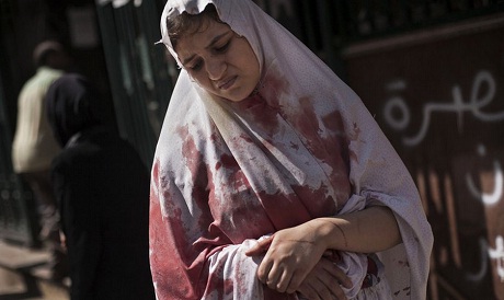 Một phụ nữ bị thương bước ra từ bệnh viện Dar El Shifa ở thành phố Aleppo, Syria.