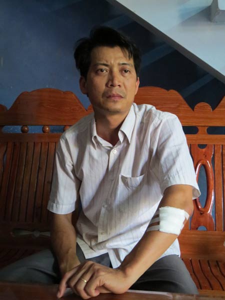 Nạn nhân Nguyễn Kim Dũng với vết thương bị rựa chém