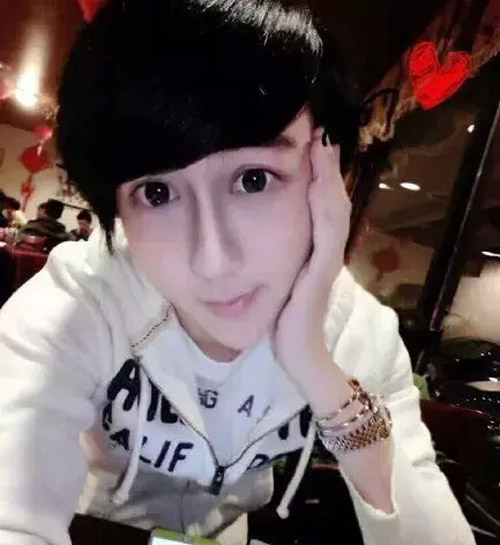 Thêm 1 “dị nhân dao kéo” 15 tuổi gây sốc ở Trung Quốc