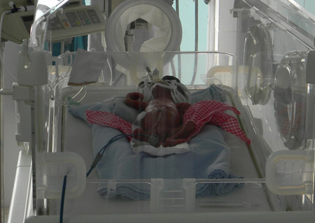 Cháu bé suýt bị chôn sống lúc còn điều trị tại Bệnh viện Nhi Quảng Nam.