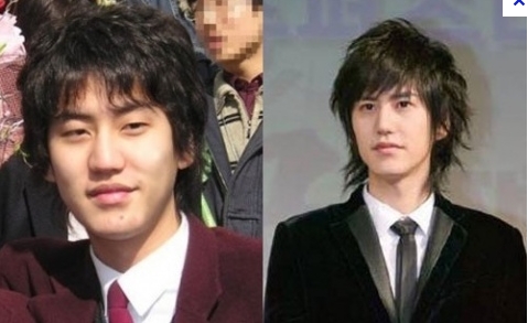 Kyuhyun của Super Junior trước và sau khi phẫu thuật mí mắt