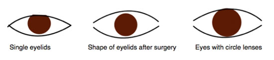 Từ trái sang: Mắt một mí tự nhiên, tròng mắt thay đổi sau phẫu thuật nâng mí và tròng mắt thay đổi nếu bạn sử dụng kính áp tròng.