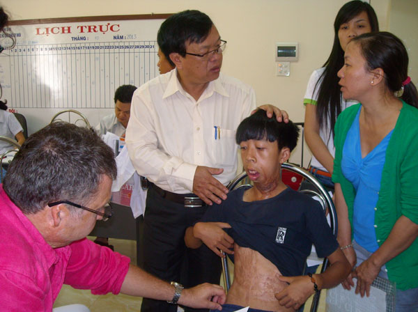 Bác sĩ của tổ chức Children Action khám trước khi phẫu thuật lành sẹo cho trẻ em nghèo Lâm Đồng (Nguồn ảnh: Báo Lâm Đồng)