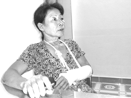 Bà Nguyễn Thị Liễu với cánh tay bị gãy do nghịch tử gây ra.