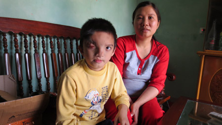 Chị Tiến, mẹ cháu Nguyễn Hoàng An mong con mình được hưởng chế độ nạn nhân chất độc da cam thế hệ thứ 3.