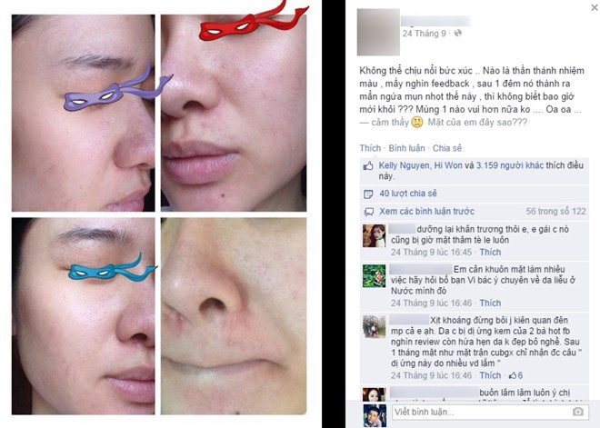 Cô gái Việt 'nát mặt' vì mỹ phẩm trôi nổi trên mạng - 1