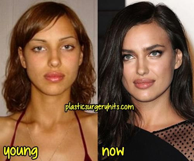 ve dep cua irina shayk la tu nhien hay nhan tao? hinh anh 7