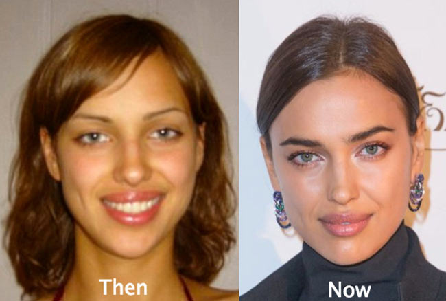 ve dep cua irina shayk la tu nhien hay nhan tao? hinh anh 4