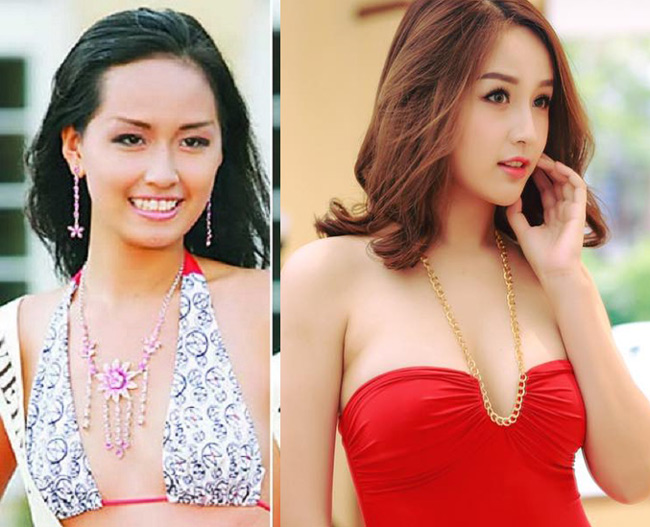 vi dau elly tran, mai phuong thuy bi nghi nang nguc, sua mat? hinh anh 13