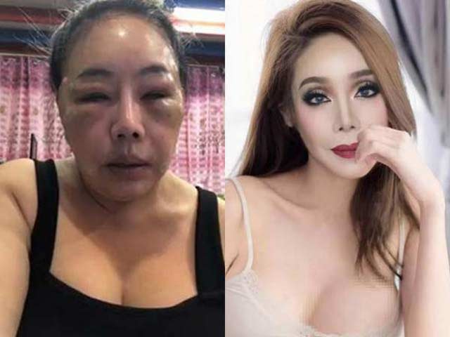 Bất ngờ nhan sắc sau dao kéo của nữ đại gia Thái Lan U60